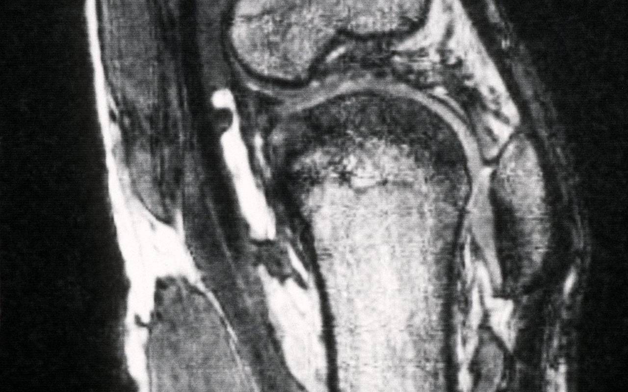 Röntgenaufnahme eines Kniegelenks