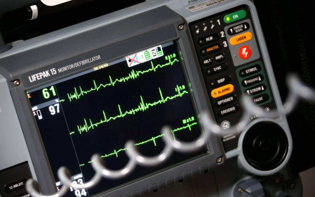 Sinusrhytmus eines Herzens ist auf einem EKG zu sehen