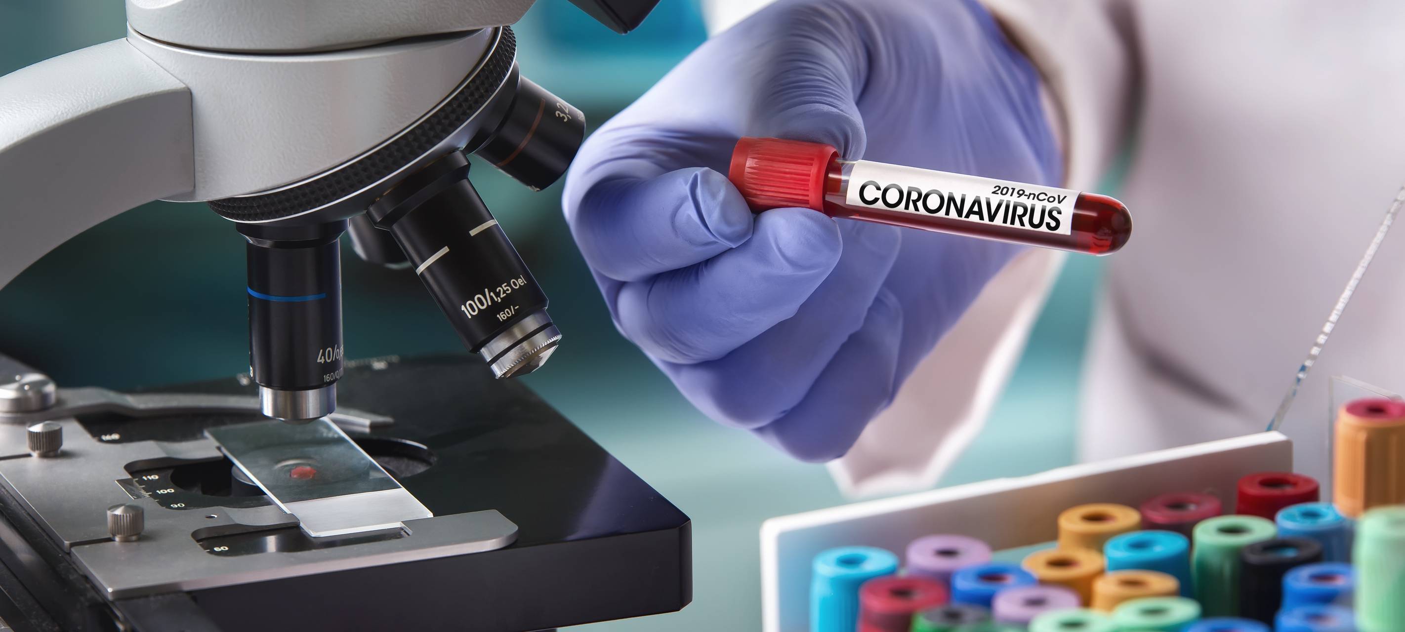 Niederrhein: Corona-Cluster in Dinslaken nach Feier in Venlo