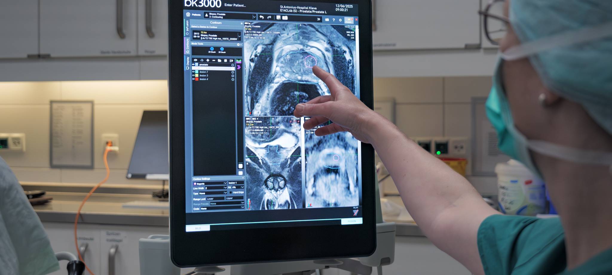 Kleve: Neue Technik für Prostatakrebs-Diagnostik